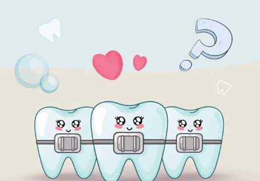 Kada je pravo vreme za aparatić?