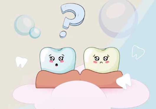 Izbeljivanje zuba kod dece