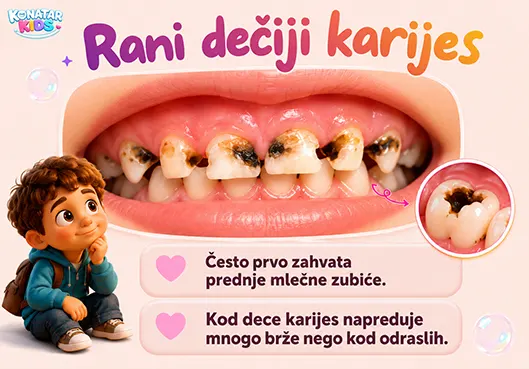 Rani dečiji karijes