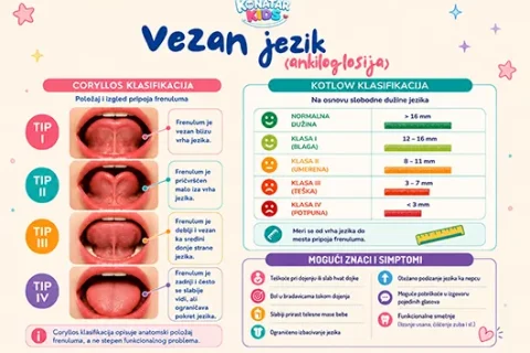 Vezan jezik – ankiloglosija