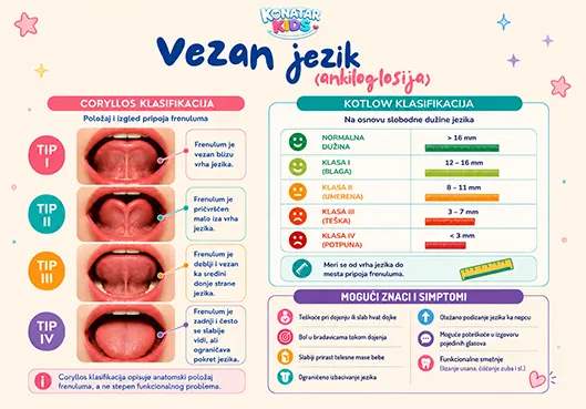 Vezan jezik – ankiloglosija